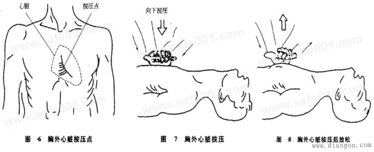 触电急救方法